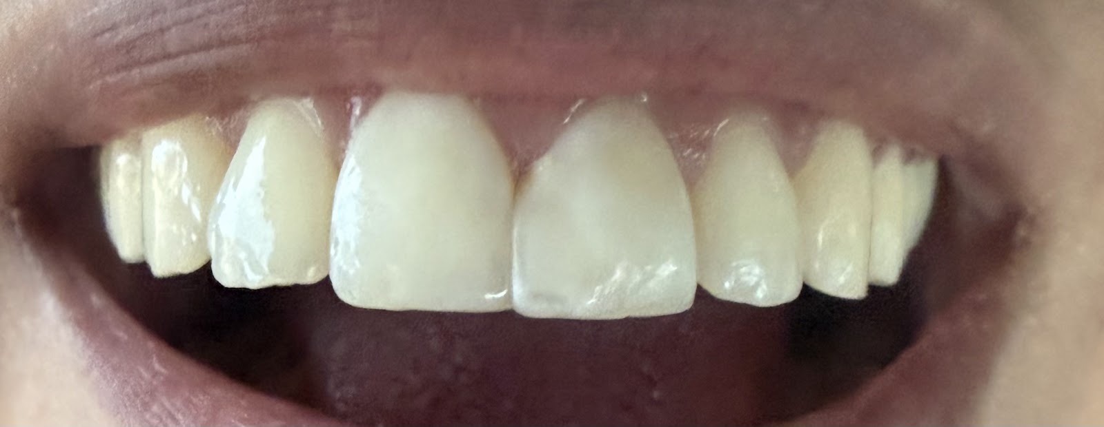 Big Dental Valle de los Chillos